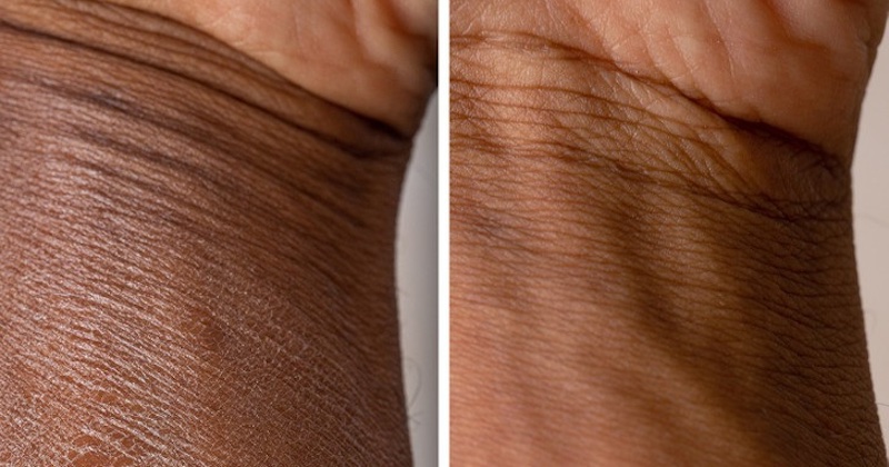 Keď pleťové mlieko nestačí: Vyskúšajte tieto potraviny na hydratáciu pokožky zvnútra