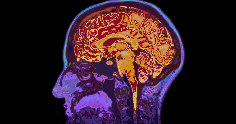 88% ľudí sa obáva Alzheimera a straty pamäti, no iba 9% vie, ako chrániť zdravie svojho mozgu 88% ľudí sa obáva Alzheimera a straty pamäti, no iba 9% vie, ako chrániť zdravie svojho mozgu