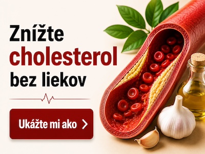 Ako znížiť cholesterol a vyčistiť cievy