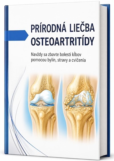 e-Kniha: Prírodná liečba osteoartritídy